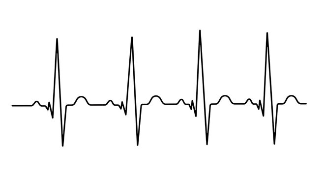 Graphic representation of a heartbeat using an electrocardiogram (ecg) waveform pattern isolated on transparent background