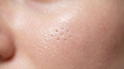 Fototapeta premium Large skin pores, oily texture, and natural shine on human cheek, showing detailed facial skin surface and healthy complexion in close up macro view