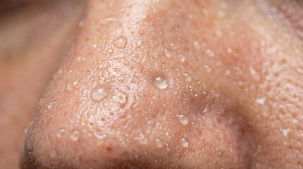 Fototapeta premium Close up human nose skin with visible pores, water droplets, facial hair, and natural texture, showing oily and moist surface in macro detail