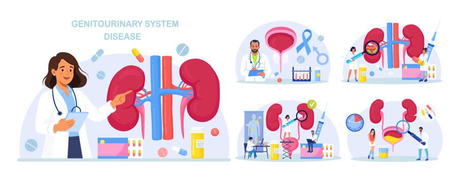 Set of Urinary Tract Infections. Kidneys and Bladder Disease Treatment. UTI Medical Concept. Nephrology, Urology. Doctor Diagnoses Pyelonephritis, Kidney Stones, Renal Failure, Cystitis