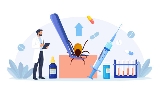 Prevention of Lyme, Encephalitis Diseases. Doctor Removes Encephalitis Ticks. Parasite Carrying Disease. First Aid with Infections Transmitted by Mites. Tick attached to skin, removed with tweezers