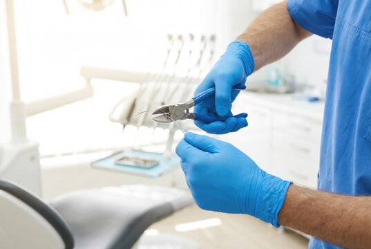 Dentist cutting orthodontic archwire with dental pliers