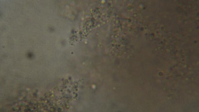 Cells under a microscope extreme macro Blood under a microscope shows individual blood cells flowing through plasma Laboratory analysis for disease detection biologist working
