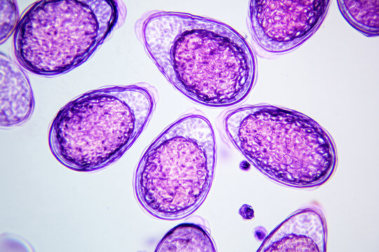 Microscopic view of Taenia solium eggs under light microscopy, concept of parasitology, medical research, and laboratory diagnostics.