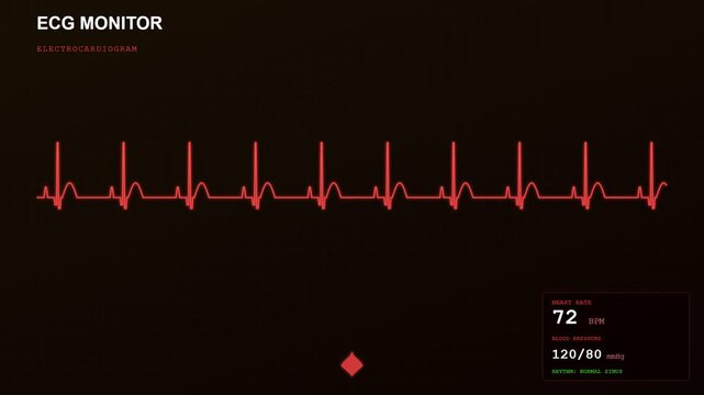 This sophisticated system for Human Wellbeing Monitoring displays a pulsating red electrocardiogram wave scrolling across a dark screen with fluctuating vital signs for medical diagnosis