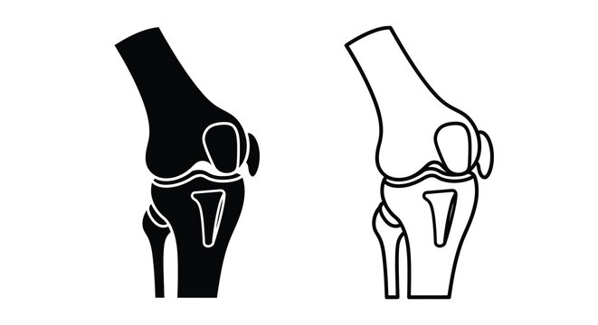 Anatomical illustration depicting a human knee joint in contrasting views