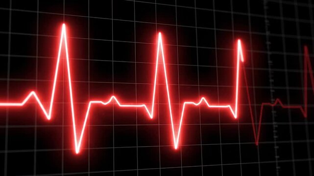 Dynamic red electrocardiogram pulse line on a dark grid background