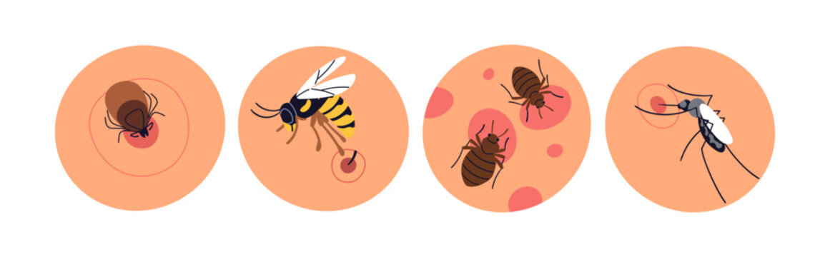 Insect bites set. Ticks, mites, bee with sting, bed bugs and mosquito. Red marks and spots, allergy, rash, redness on skin after bloodsuckers. Flat vector illustrations isolated on white background