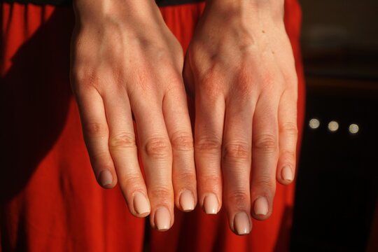 Ausgestreckte H&auml;nde mit gepflegten Fingern&auml;geln vor roten Hosenbeinen von schlanker junger Frau bei Sonne am Abend im Sommer