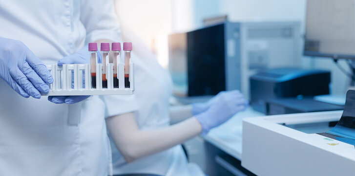 Laboratory technician holding blood sample tubes for clinical testing and diagnostic analysis with analyzer equipment in medical laboratory workstation, banner