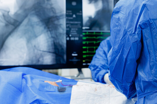 Interventional cardiology procedure with live fluoroscopy monitor and cardiac telemetry in operating room for catheterization