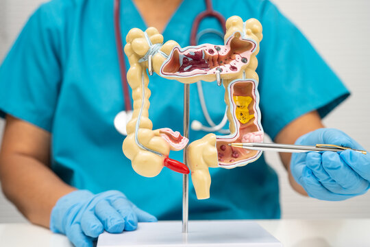 Intestine, doctor holding human anatomy model for study diagnosis and treatment in hospital.