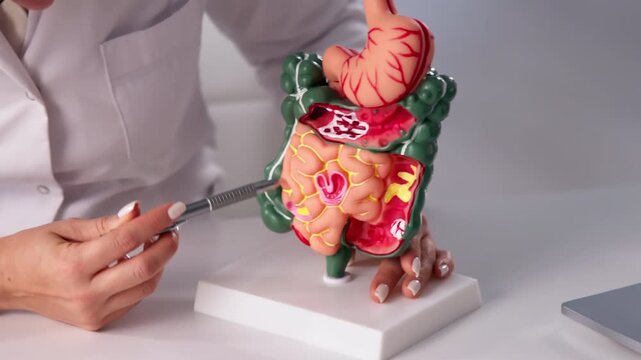 Doctor Explains Colon Polyps Carefully