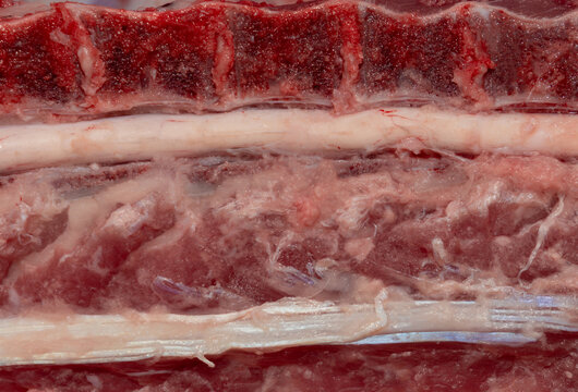 Longitudinal section through the spine