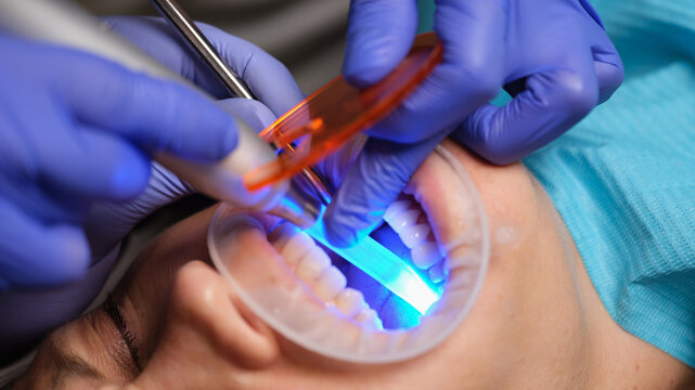 In a modern dental clinic, a professional performs a teeth whitening treatment using a blue light through a protective barrier. The patient appears relaxed during the process.