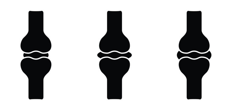 Structure of the knee joints. Cartoon knee bones. Bones icon set. Anatomy, human knee bone snatomy concept. Broken knee joint with pain. Bone joints. Science design.  Human leg.