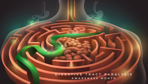 Digestive Tract Paralysis Awareness Month Concept Image, featuring digestive disorders, gut function, and patient care.