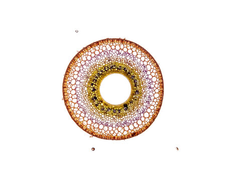 Cross-section of a plant stem vascular bundle with central vessel and ring of tissues