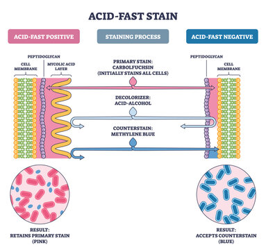 Acid-fast stain process compares positive vs negative cells, showing carbolfuchsin, acid-alcohol, methylene blue, key objects, mycolic acid layer, cell wall, bacilli. Outline diagram