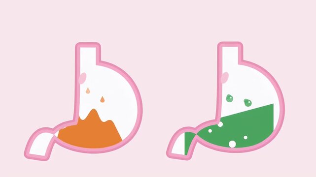 Animated comparison of an acidic stomach with heartburn and a healthy stomach with green liquid representing relief.