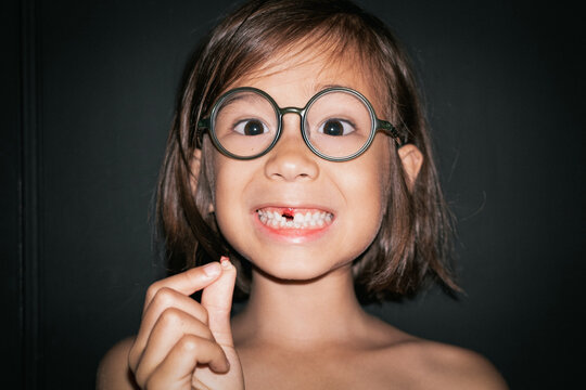 Loose Tooth