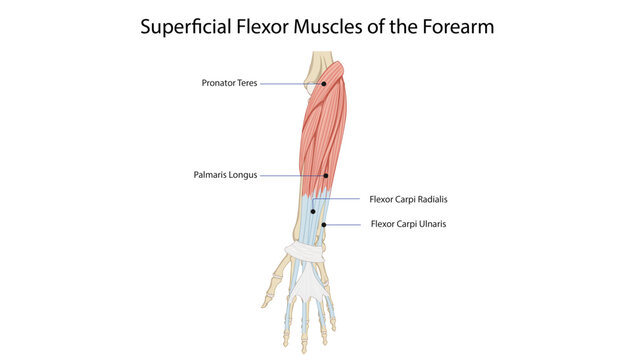 Superficial Flexor Muscles of the Forearm
superficial anterior forearm muscles including pronator teres, palmaris longus, and wrist flexors.