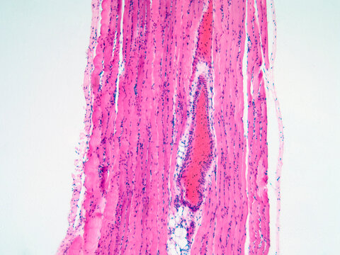 Striated Muscle Tissue Micrograph