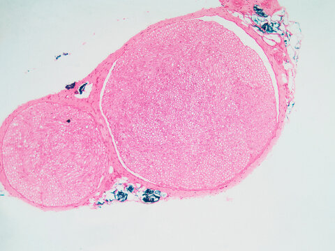 Peripheral Nerve Cross Section