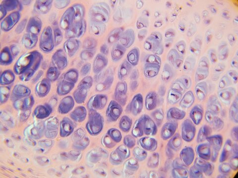 Hyaline Cartilage Micrograph