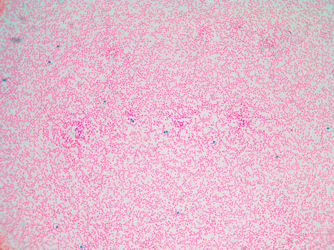 Human Blood Smear Overview