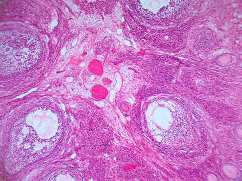 Mammalian Ovary Follicle Micrograph