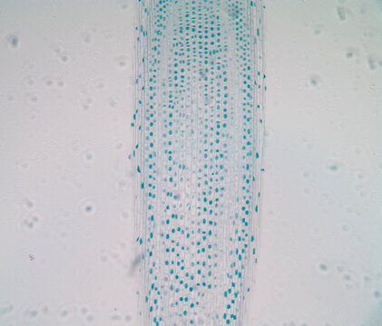 Onion Root Tip Micrograph