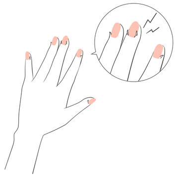 傷んだ手のイラスト　ささくれ