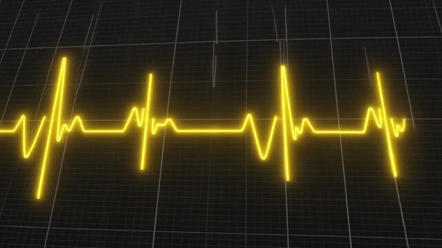 Bright yellow electrocardiogram waveform on dark grid background, repeating peaks and valleys, symbolizing rhythm, vitality, medical monitoring, and life energy in luminous modern digital aesthetic.