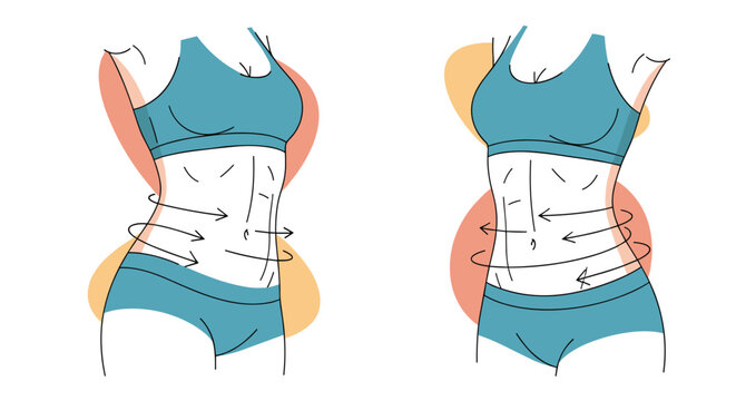 Medical illustration shows a woman's midsection with arrows indicating waist slimming and body firming results.