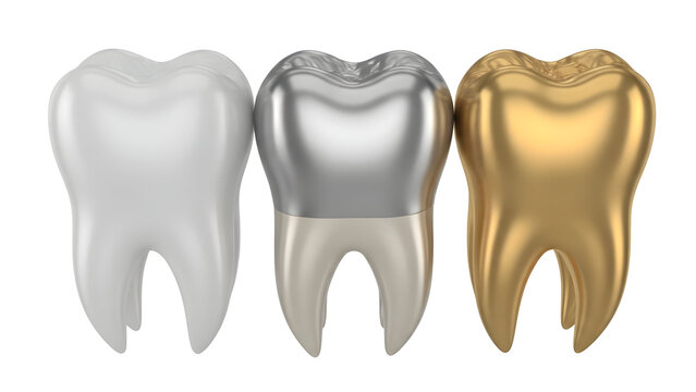 Three metallic teeth silver gray and gold dental health and materials