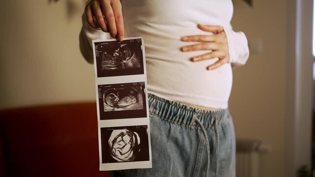 Proud pregnant woman lovingly caressing her growing belly while holding up a sonogram picture of her unborn baby, showing the healthy development and symbolizing the beautiful journey of motherhood