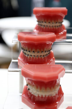 ortodoncia dental