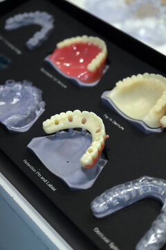 tratamientos dental