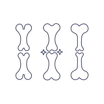 Illustration of bone fracture and healing process with internal fixation