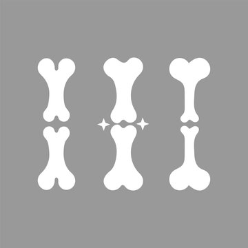 Illustration of bone fusion or joint replacement process involving two femur bones