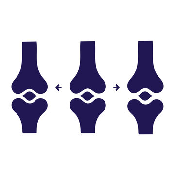 Illustration of knee joint movement showing flexion and extension