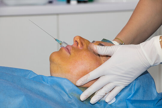 Anesthesia administered before a facelift using absorbable threads. Close-up.