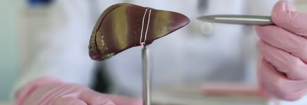 Doctor examines liver model focusing on diseases.