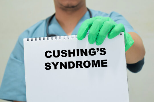 Doctor holds in hands a book with the name of the Cushing's syndrome. Medical concept