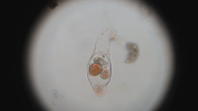 Microscopic look at significant parasite motion inside a Rotifer 