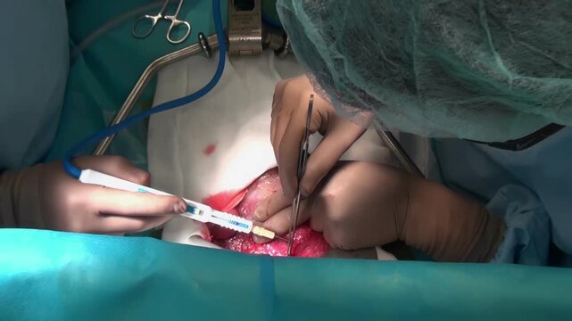 At the operating room, during open surgery, the surgeon uses medical tools to work inside the patient's body. Gloved hands are using forceps and a needle for a delicate procedure.