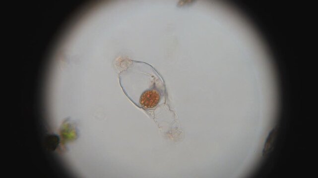 Microscopic Parasite Escapes From Rotifer Remains - Magnification 400X