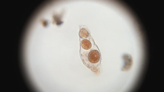 Parasites Moving Inside a Rotifer 