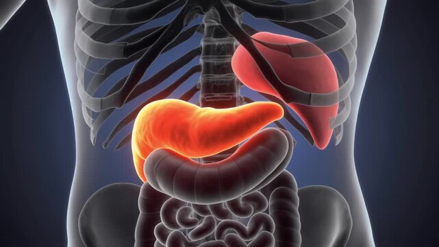 3D Medical Animation of Inflamed Pancreas for Acute Pancreatitis